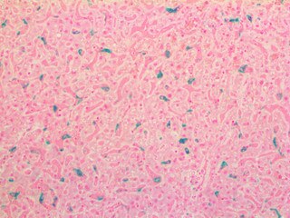 IHC of Macrophage on an FFPE Liver Tissue
